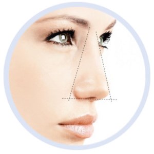 Methods for correcting keloid scars after rhinoplasty