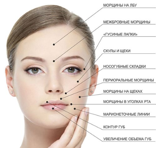 Relatox or Botox - which is better? Beauty Injection Injection Comparison