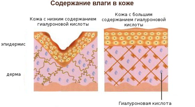 Hyaluronic acid injections for the face (lips, under the eyes, forehead). Before and after photos