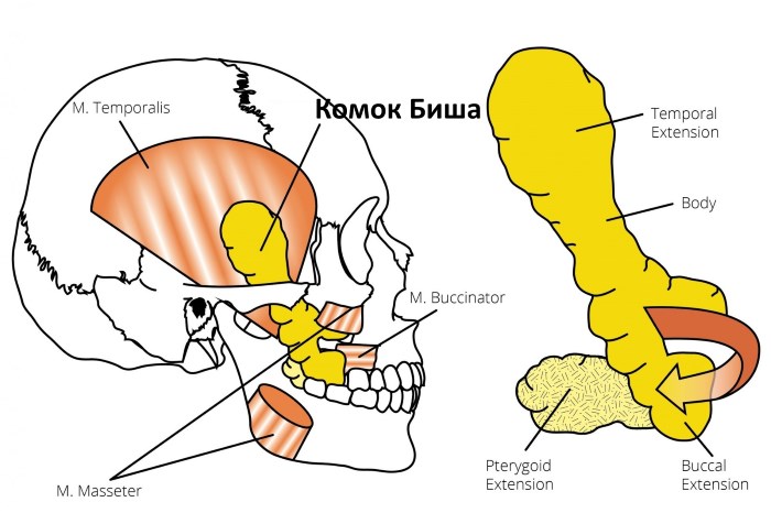 Lumps of Bisha. What is it, how is it removed, the operation, how to clean it at home