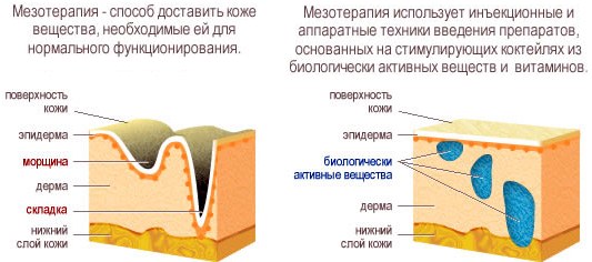 Facial mesotherapy - what is it. Photos before and after, reviews, at what age