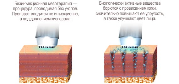 Facial mesotherapy - what is it. Photos before and after, reviews, at what age