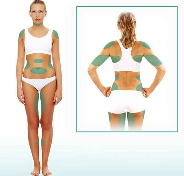 Body liposuction. How much, price, before and after photos, video, reviews