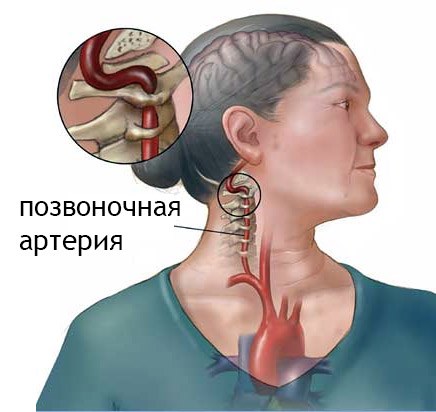 Exercises of Dr. Shishonin for the neck with osteochondrosis. Gymnastics complex, video