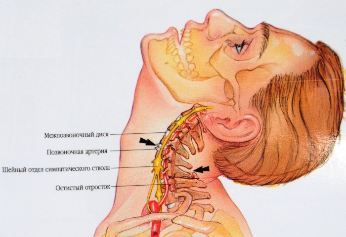 Exercises of Dr. Shishonin for the neck with osteochondrosis. Gymnastics complex, video