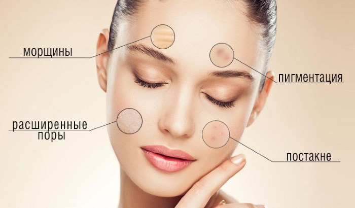 Diamond peeling for facial skin. What is it, indications, apparatus, price of the procedure, photo