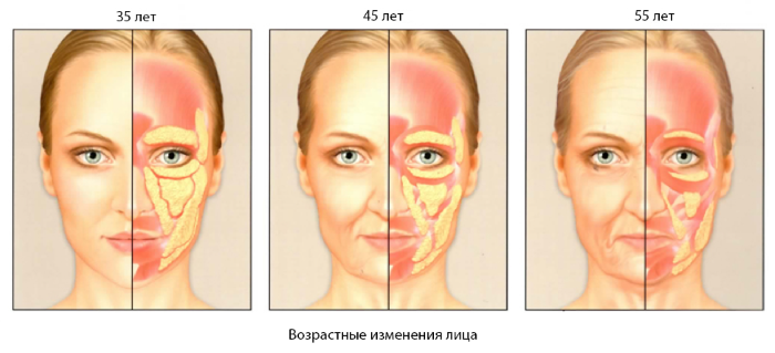 What is lipofilling? Lipofilling of the face, breasts, buttocks, price, before and after photos