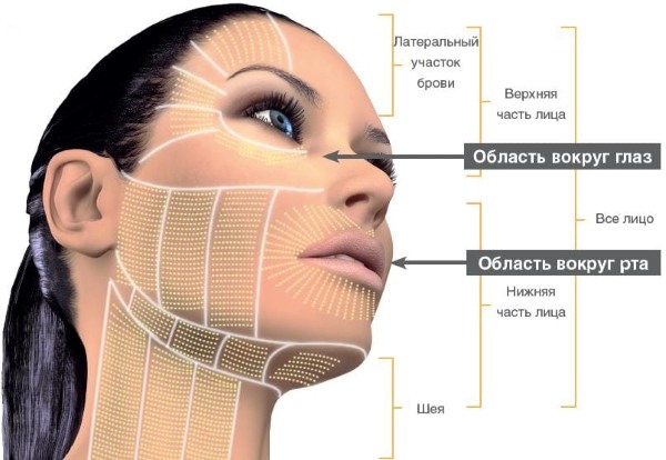 Facelift for the face - exercises, surgery, facelift