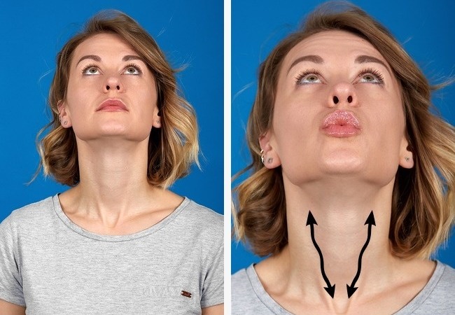 Facelift for the face - exercises, surgery, facelift