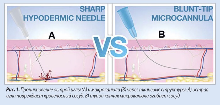 Cannula in cosmetology and medicine