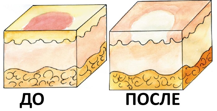 Face creams in pharmacies