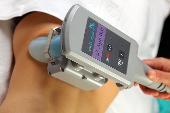 Cryolipolysis (cryoliposuction). What is it, price, reviews