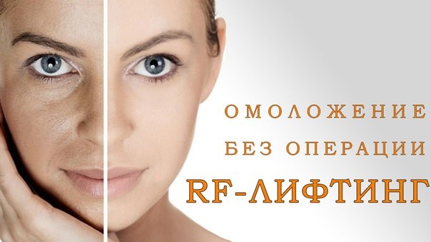 Face lifting - what is this procedure. RF-lifting, facial threads, non-surgical lifting