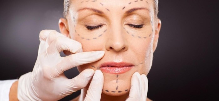 Face lifting - what is this procedure. RF-lifting, facial threads, non-surgical lifting