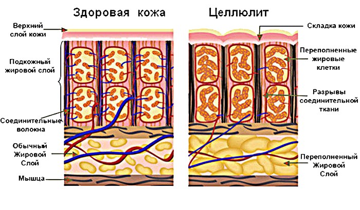 Lymphatic drainage massage. What is this procedure for losing weight, hardware, massage at home. Photo, video