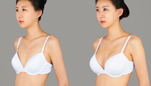 Mammoplasty - plastic surgery of the mammary glands. Photos before and after, cost, reviews