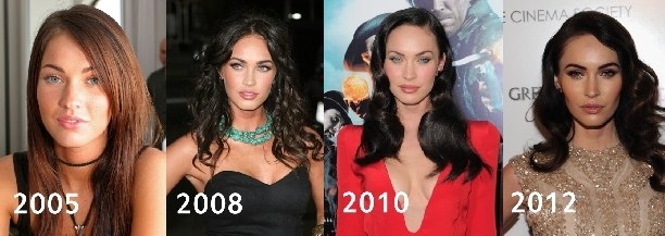 Megan Fox before and after face plastic surgery. Photo when I did plastic surgery on lips, eyes, nose, cheekbones