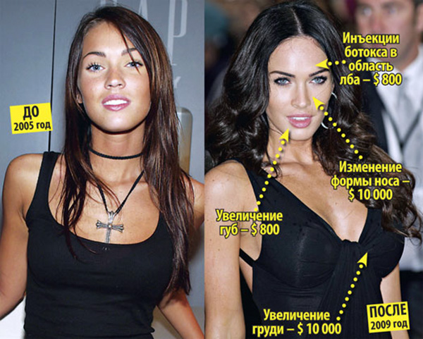 Megan Fox before and after face plastic surgery. Photo when I did plastic surgery on lips, eyes, nose, cheekbones