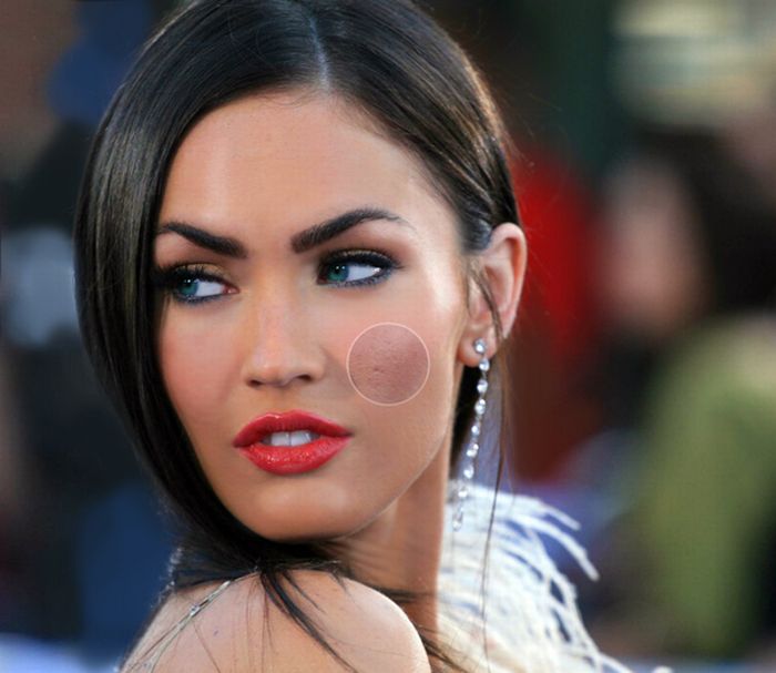 Megan Fox before and after face plastic surgery. Photo when I did plastic surgery on lips, eyes, nose, cheekbones