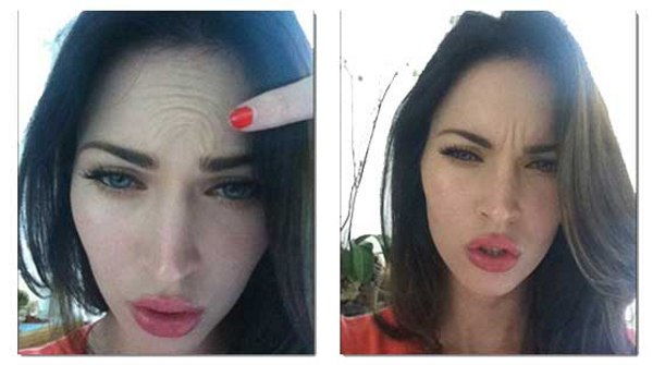 Megan Fox before and after face plastic surgery. Photo when I did plastic surgery on lips, eyes, nose, cheekbones