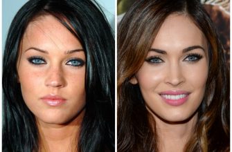 Megan Fox before and after face plastic surgery. Photo when I did plastic surgery on lips, eyes, nose, cheekbones