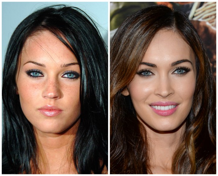 Megan Fox before and after face plastic surgery. Photo when I did plastic surgery on lips, eyes, nose, cheekbones