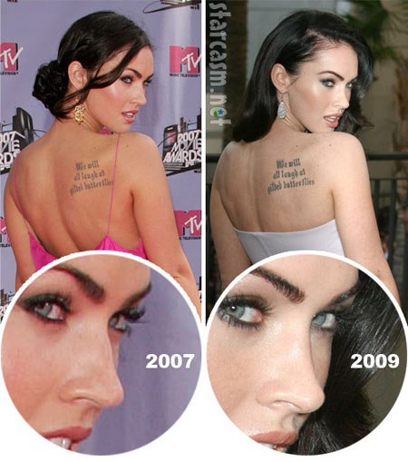 Megan Fox before and after face plastic surgery. Photo when I did plastic surgery on lips, eyes, nose, cheekbones