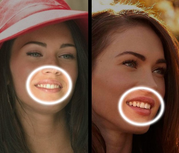 Megan Fox before and after face plastic surgery. Photo when I did plastic surgery on lips, eyes, nose, cheekbones