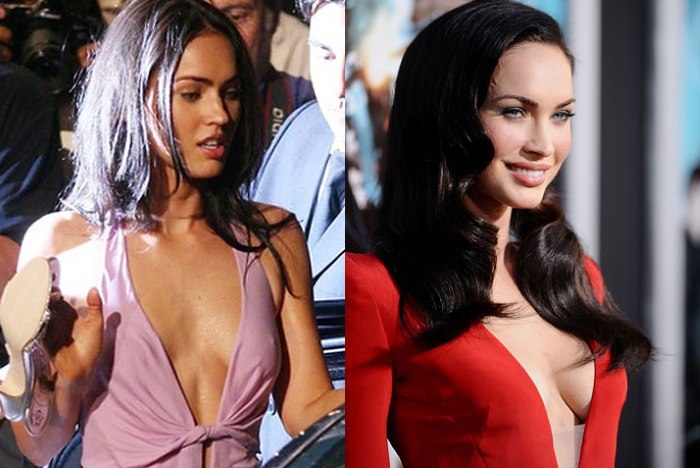 Megan Fox before and after face plastic surgery. Photo when I did plastic surgery on lips, eyes, nose, cheekbones