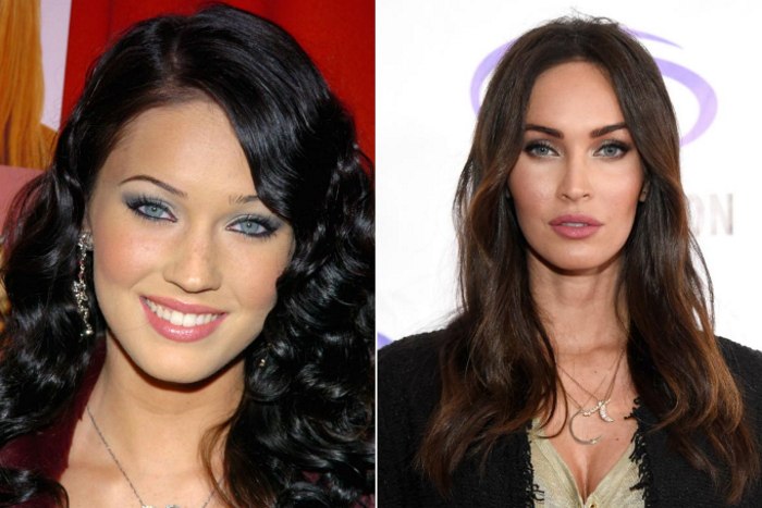 Megan Fox before and after face plastic surgery. Photo when I did plastic surgery on lips, eyes, nose, cheekbones