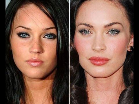 Megan Fox before and after face plastic surgery. Photo when I did plastic surgery on lips, eyes, nose, cheekbones