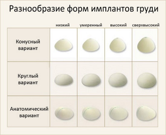 Tubular form of mammary glands, breasts. Photo, correction without surgery for women, men