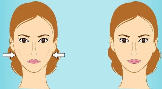 Cheekbones with hyaluronic acid. Before and after photos, cost of the procedure, reviews