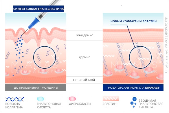 Bioreparation - what is it, the action of the procedure, the effect, the drugs that are used: Gialripier, Aquashine, photo, price, reviews