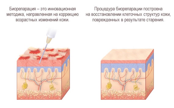 Bioreparation - what is it, the action of the procedure, the effect, the drugs that are used: Gialripier, Aquashine, photo, price, reviews