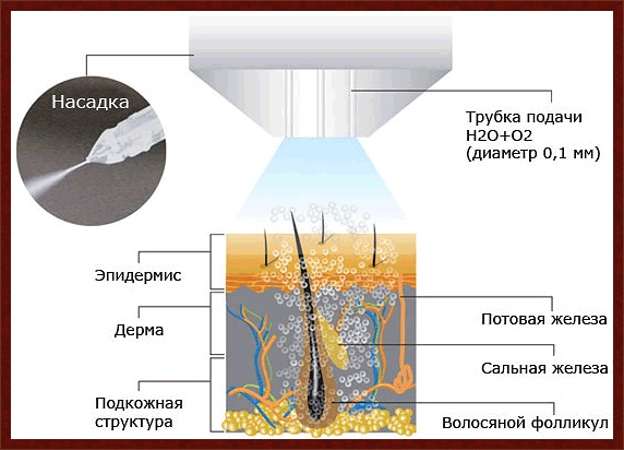 Bioreparation - what is it, the action of the procedure, the effect, the drugs that are used: Gialripier, Aquashine, photo, price, reviews