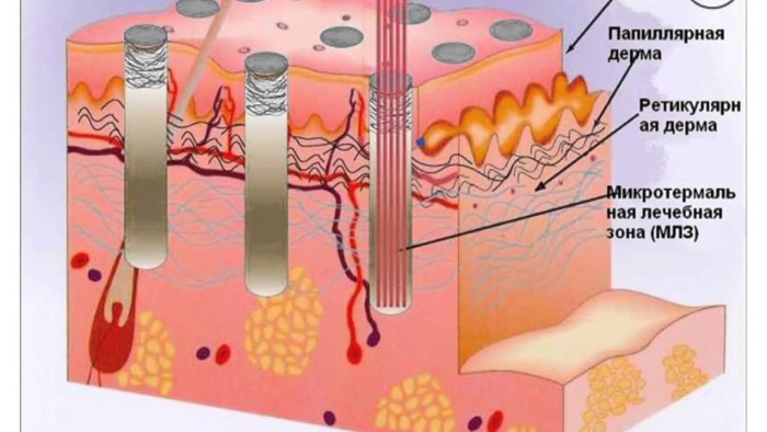 Bioreparation - what is it, the action of the procedure, the effect, the drugs that are used: Gialripier, Aquashine, photo, price, reviews