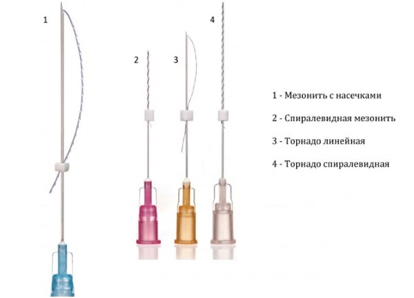 What is mastopexy