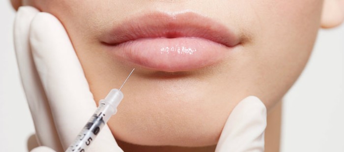 Lip contouring - a technique of augmentation with hyaluronic acid, fillers. Photos and prices