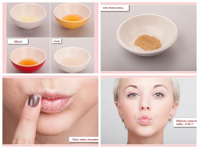 Lip contouring - a technique of augmentation with hyaluronic acid, fillers. Photos and prices