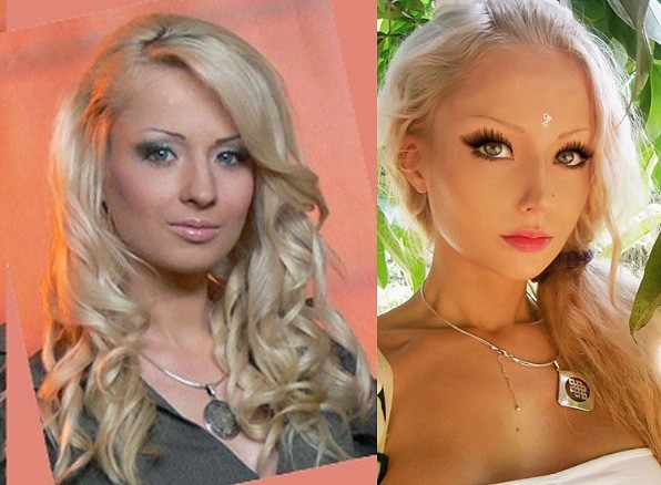 Lukyanova Valeria before and after plastics. Photo of the girl Barbie (Amatue) on Instagram, Vkontakte