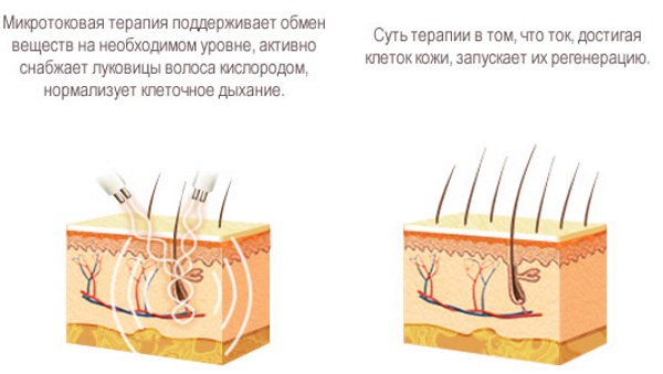 Mikroströme für das Gesicht in der Kosmetologie - ein Gerätetherapieverfahren. Preis, Bewertungen