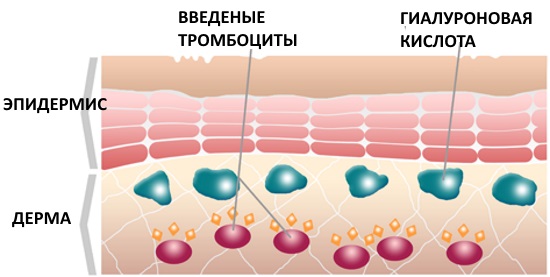 Plasma therapy - plasmolifting of the skin of the face and neck, indications, contraindications, photos, price of the procedure, reviews