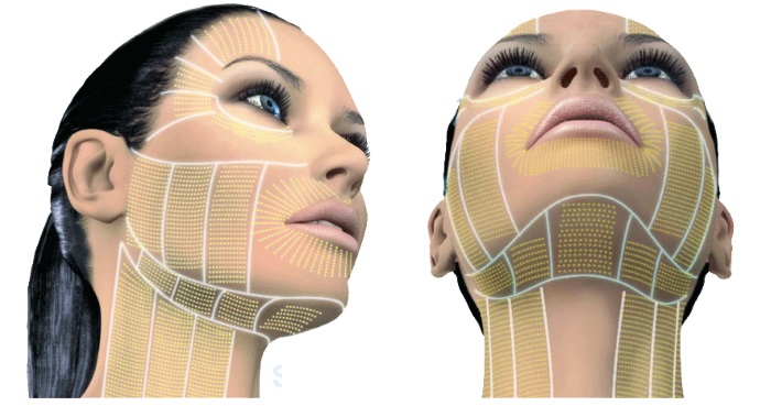 Plasma therapy - plasmolifting of the skin of the face and neck, indications, contraindications, photos, price of the procedure, reviews