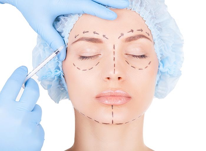 Radiesse - filler preparation for vector lifting in cosmetology