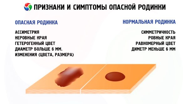 Laser removal of moles, surgical method, at home. Consequences, how long the wound heals, scars