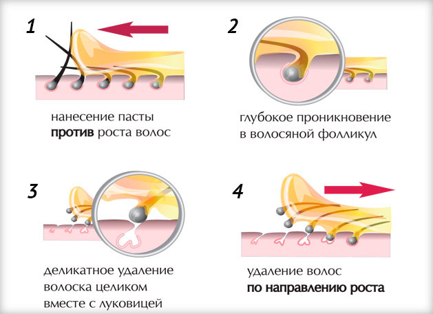 Shugaring paste, how to cook sugar paste with lemon, in the microwave, recipe, how to use