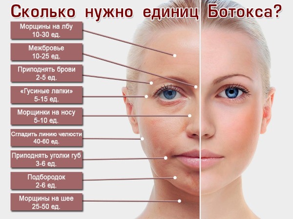 What is botox for the face, injections, injections of nano botox in the forehead, nasolabial folds, armpits