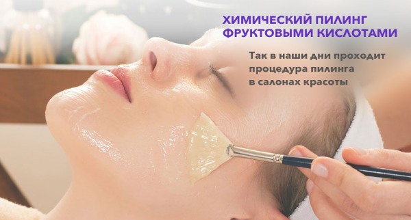 Chemical peeling of the face - what is it, how is it done at home, types and features