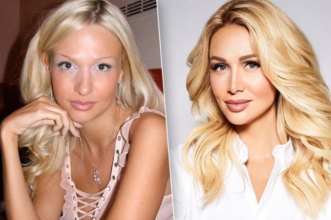 Victoria Lopyreva. Photos before and after plastic surgery, growth, biography, personal life, Basque, Instragram